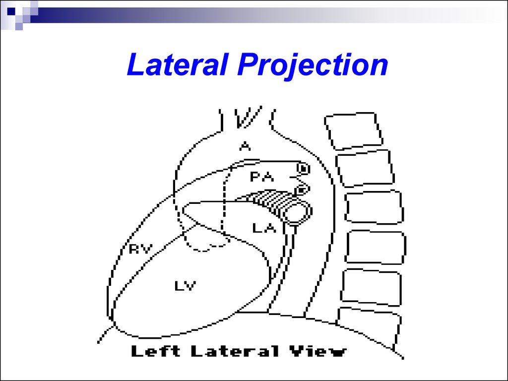 Lateral Projection