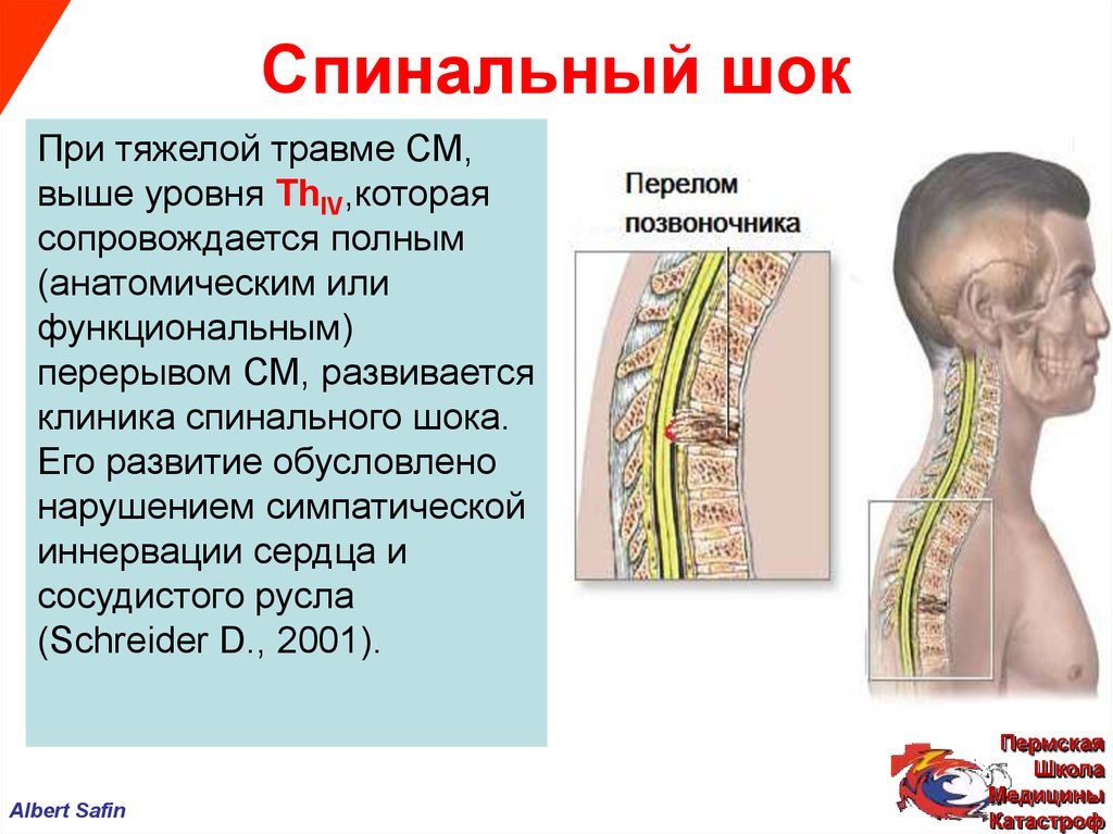 Поражение спинного. Спинальный ШОК. Травмы позвоночника и спинного мозга. Механизм спинального шока. Травматические повреждения спинного мозга.