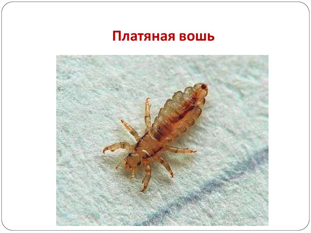 Платяная вошь