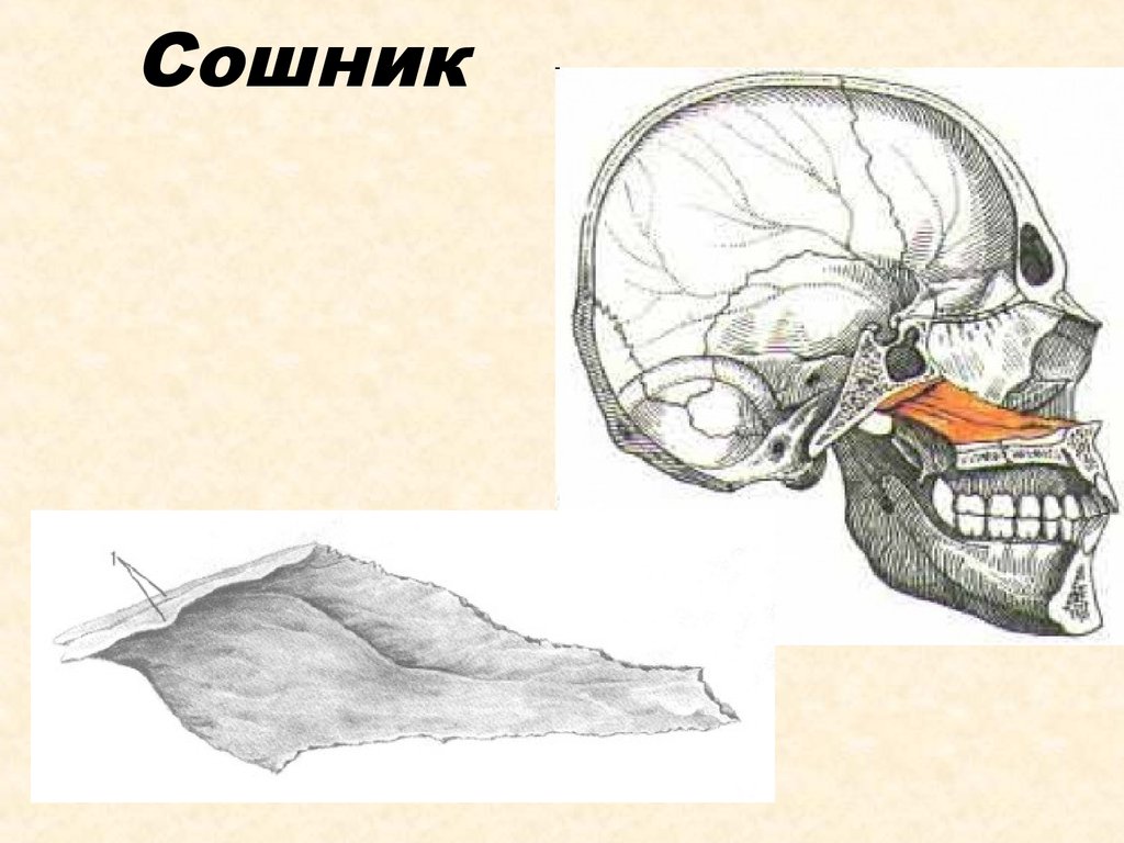 Носовая кость лицевого черепа. Сошник кость черепа. Строение черепа сошник. Сошник анатомия человека кости черепа. Сошник кость черепа анатомия.