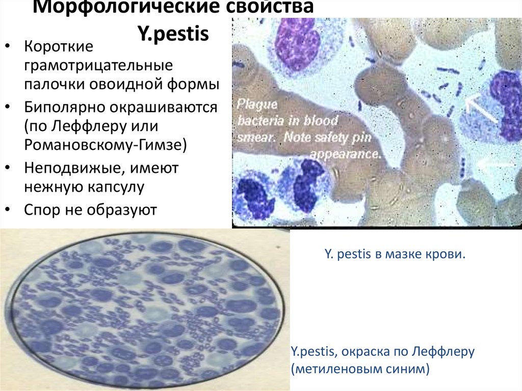 Элементарные тельца хламидий по романовскому гимзе окрашиваются