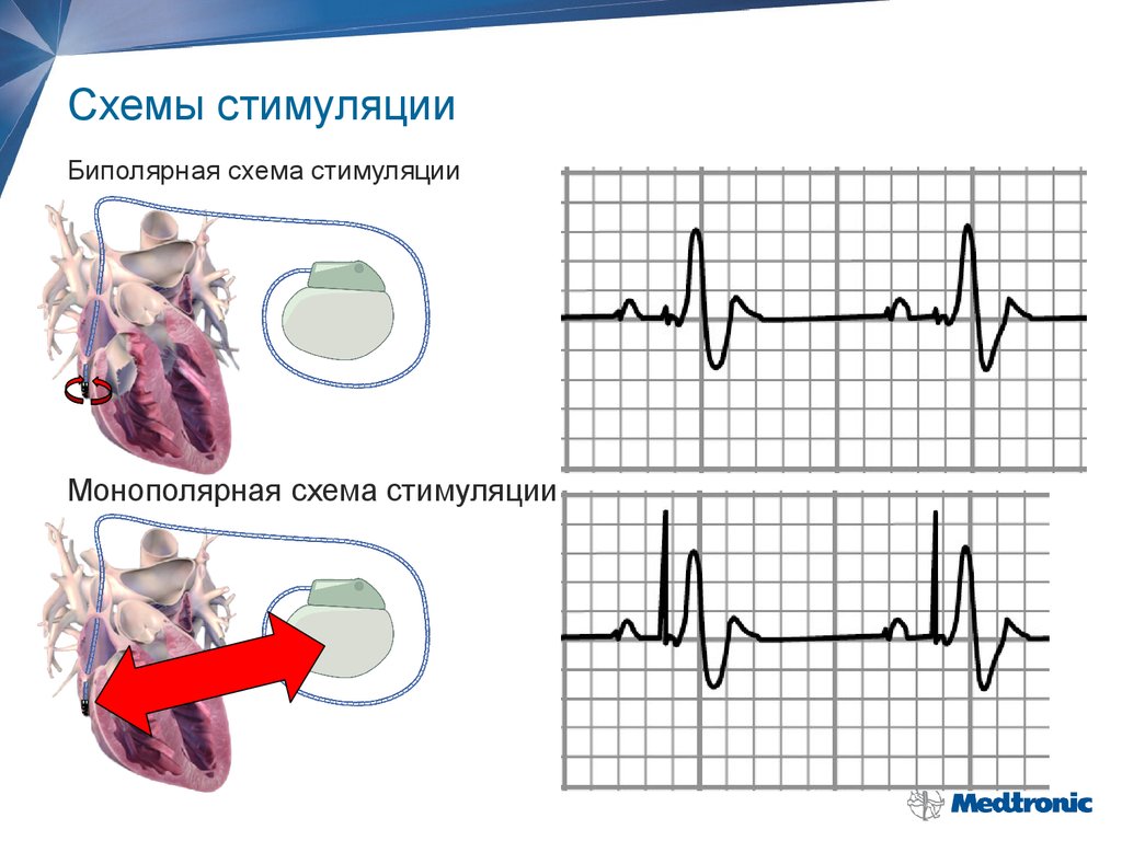 Стимуляция летрозолом схема