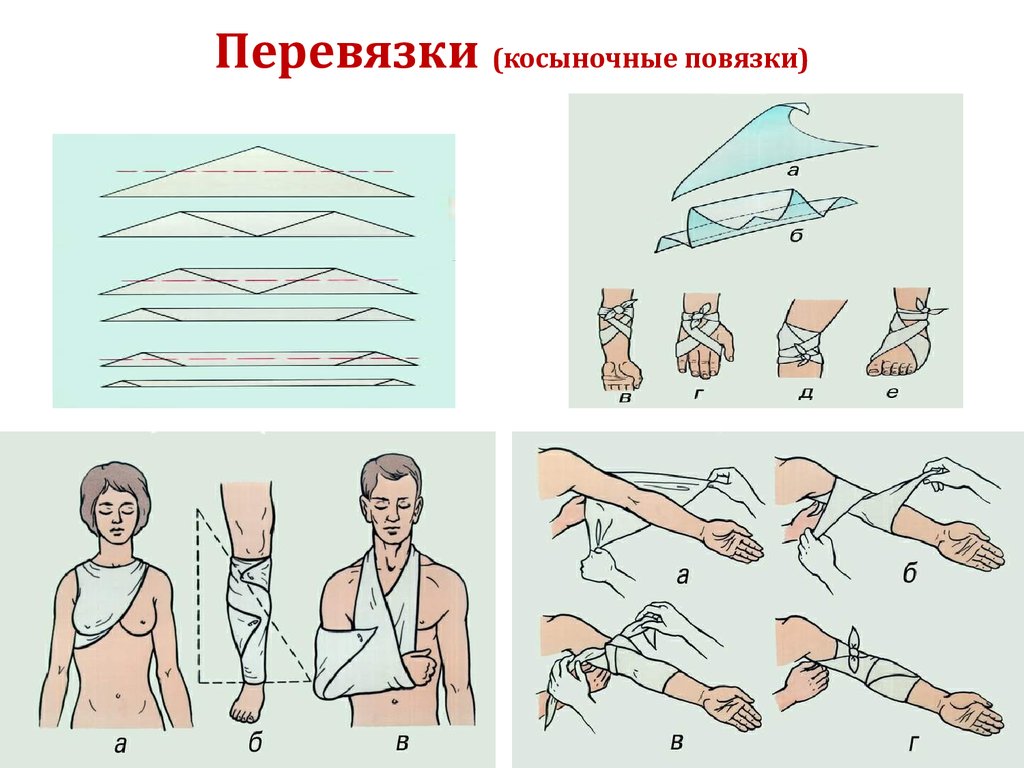 Перевязки хирургия презентация