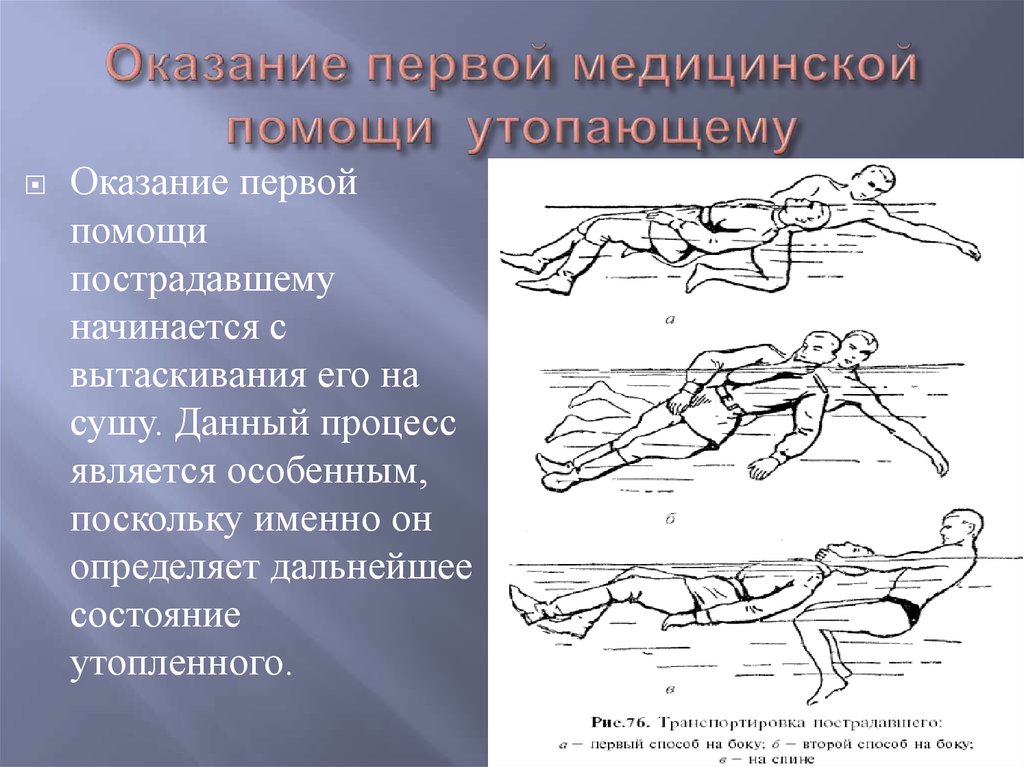 Помощь тонущему. Оказание первой помощи утопающему. Оказание первой помощи утопа. Оказание 1 помощи утопающему. Оказание первой помощи при спасении утопающего.