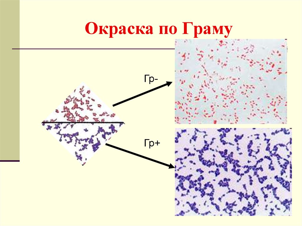 Какова окраска. Окрашивание бактерий по методу грама. Окраска мазка по методу грамма. Окраску микроорганизмов по методу грама;. Окраска по методу грама микробиология.