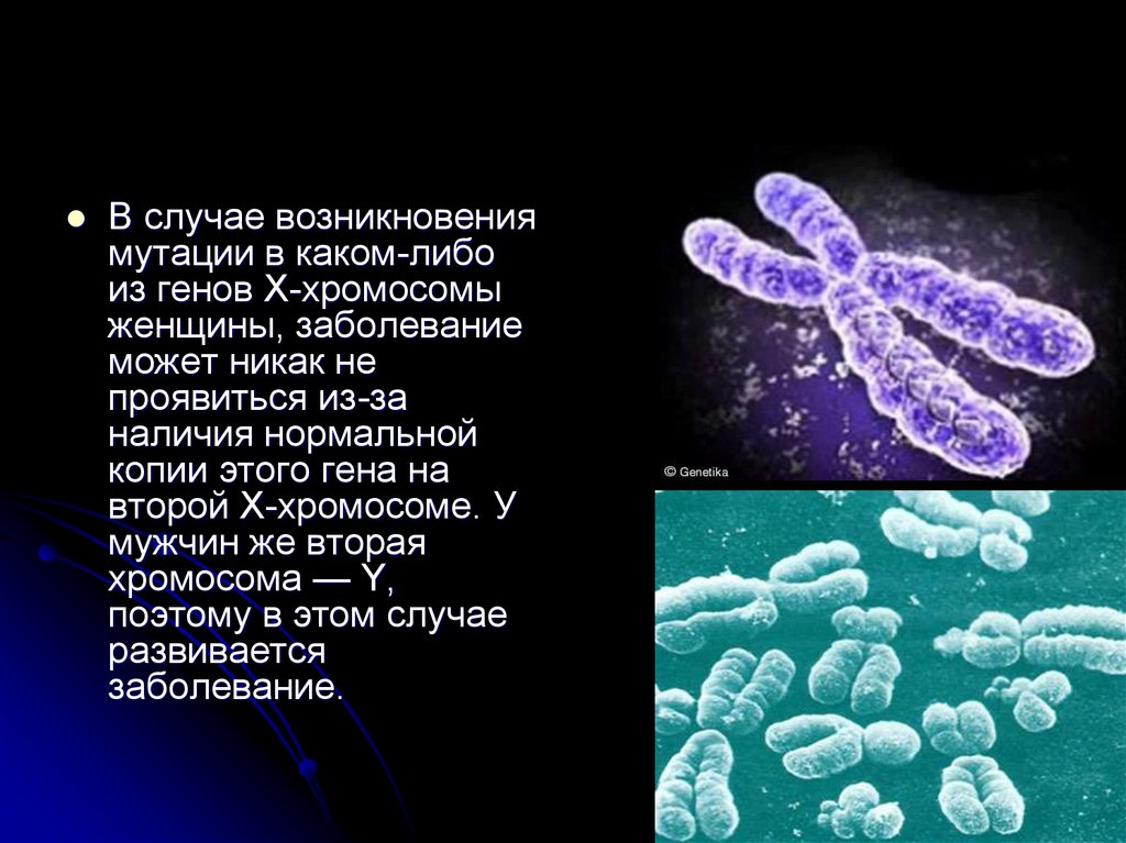 Нормальные гены х хромосомы. Хромосомные болезни генетика. Гены х хромосомы. Заболевания с х хромосомами.