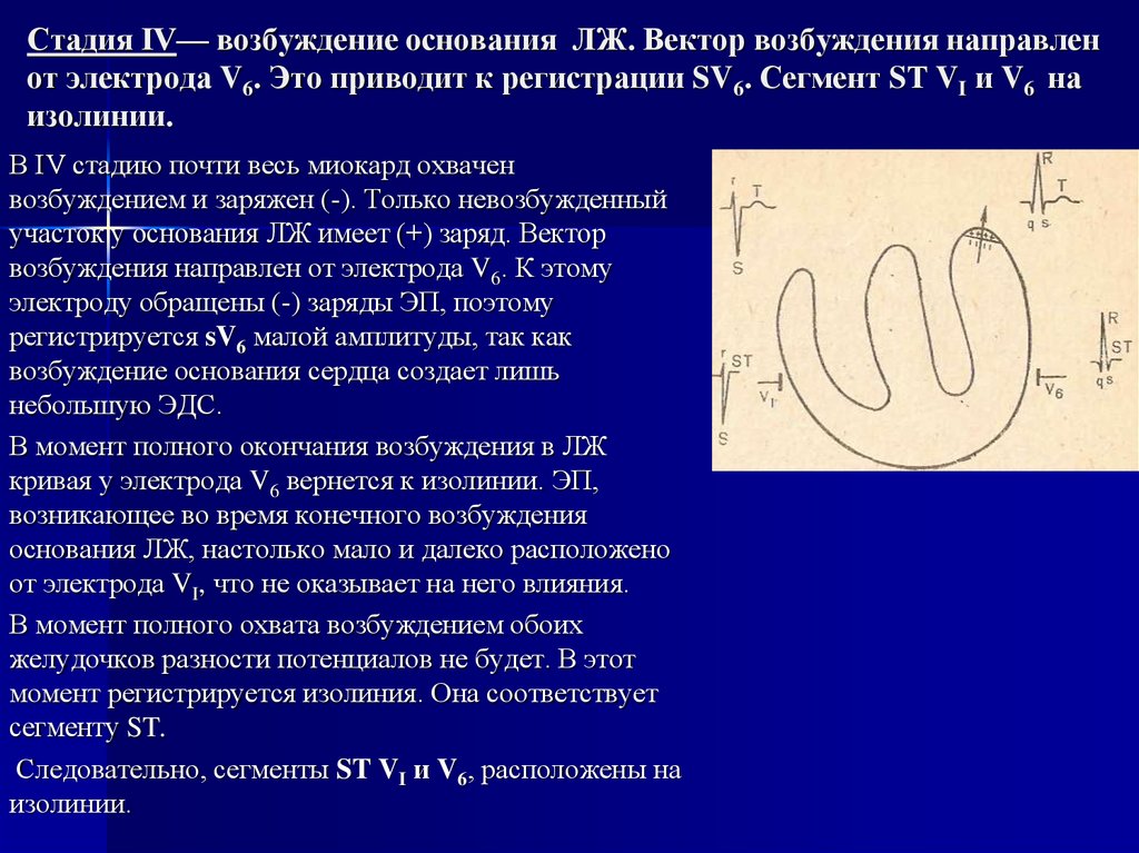 Причины возбуждения. Вектор возбуждения желудочка сердца. Вектор возбуждения сердца направлен. Степень возбуждения.