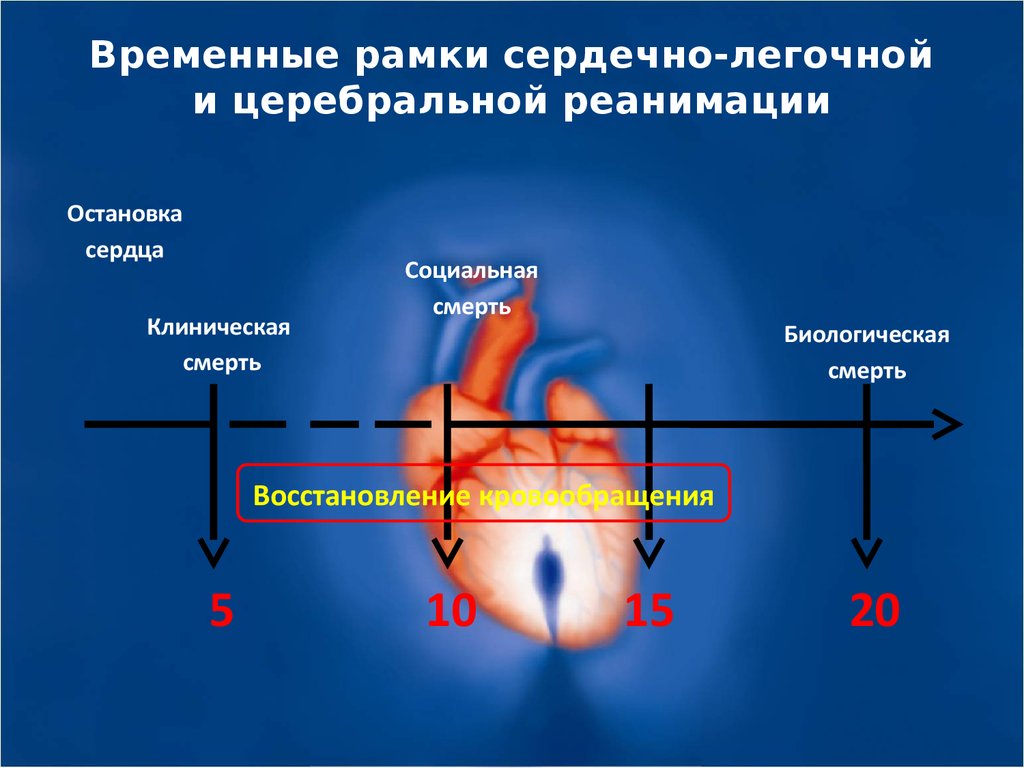 Прекращение деятельности сердца