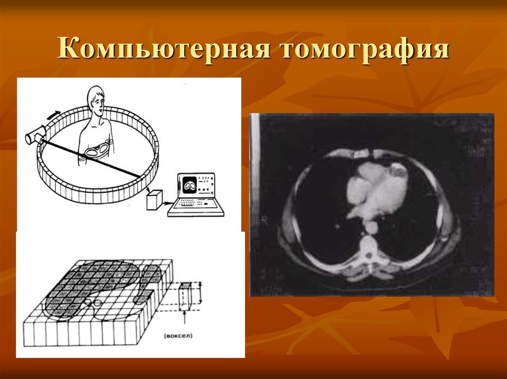 Шкала хаунсфилда презентация