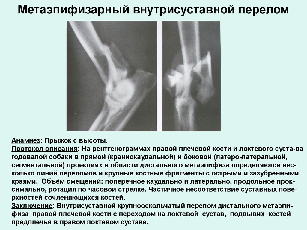 Схема описания рентгенограммы костей