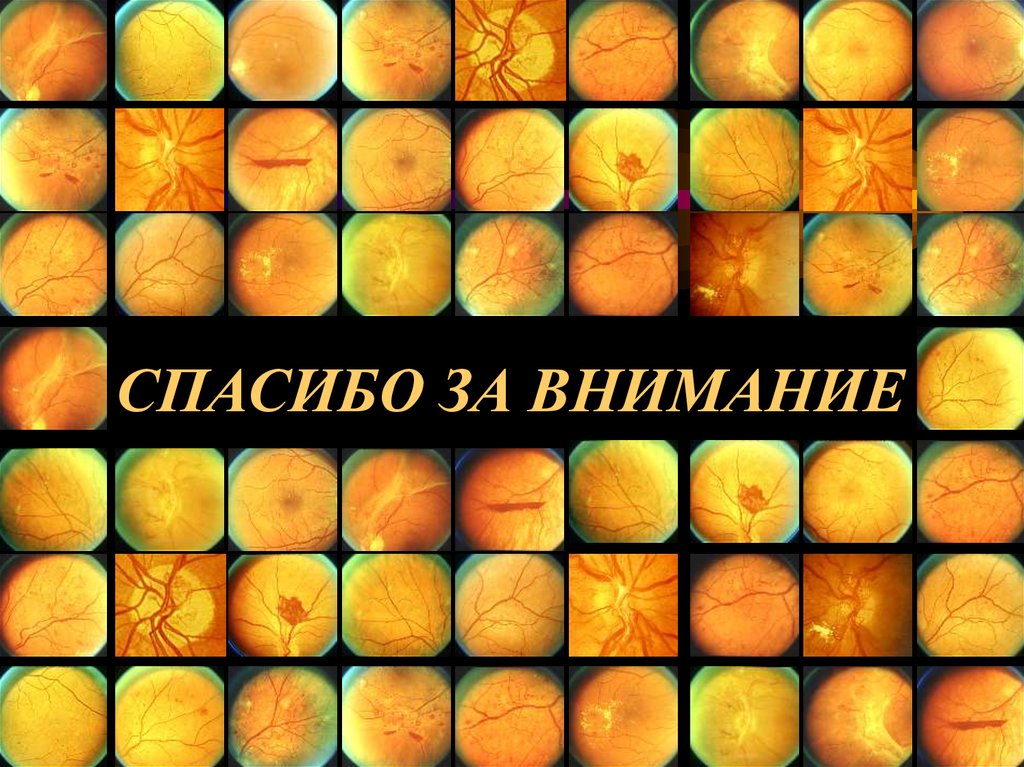 СПАСИБО ЗА ВНИМАНИЕ