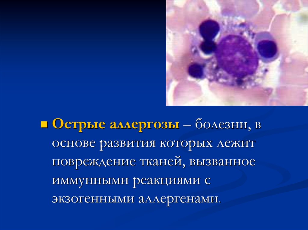 Аллергозы это. Острые аллергозы. Заболевания острых аллергозов. Острый аллергоз классификация. Острые аллергозы этиология.