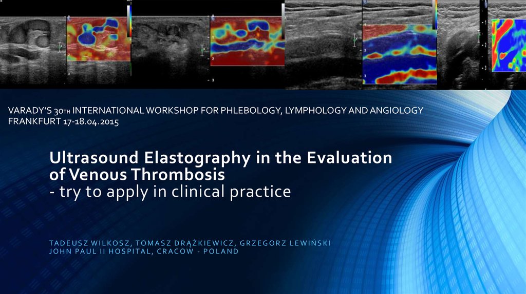 Ultrasound Elastography In The Evaluation Of Venous Thrombosis Try To Apply In Clinical