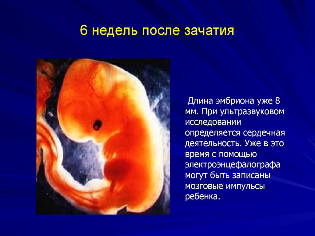 Срок плода 6 недель. Размер эмбриона в 6 недель акушерских. Плод 5-6 недели беременности размер плода. Эмбрион 5-6 недели беременности в животе. Плод на 5 недель 6 дней беременности эмбрион.
