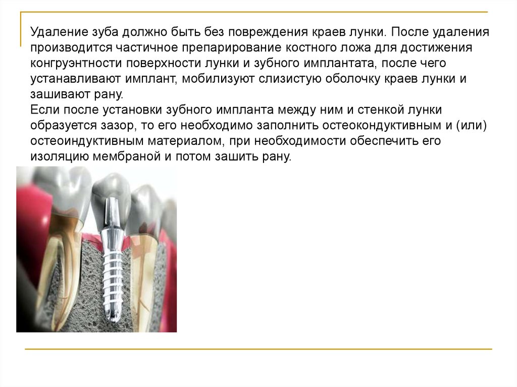 История имплантации зубов презентация