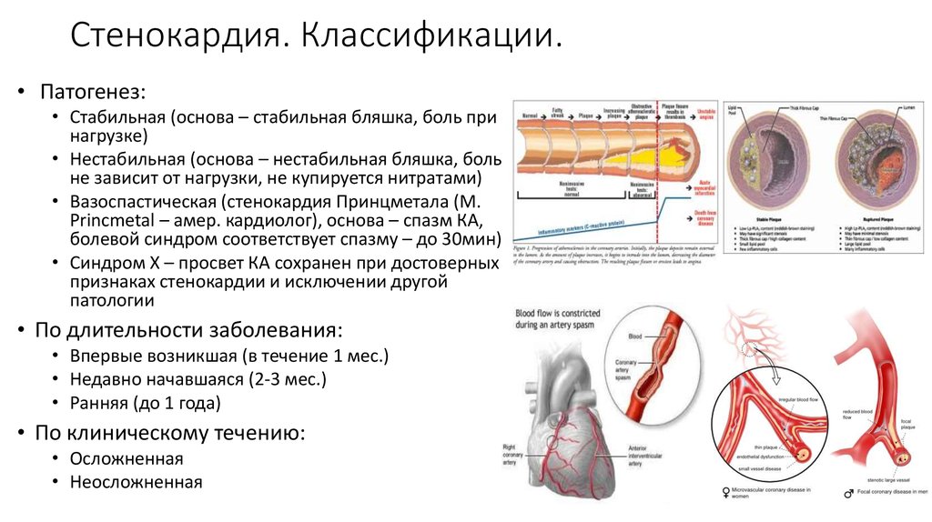 Ибс впервые возникшая стенокардия карта вызова