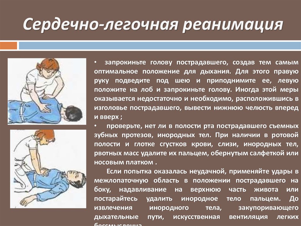 Реанимационные мероприятия действия