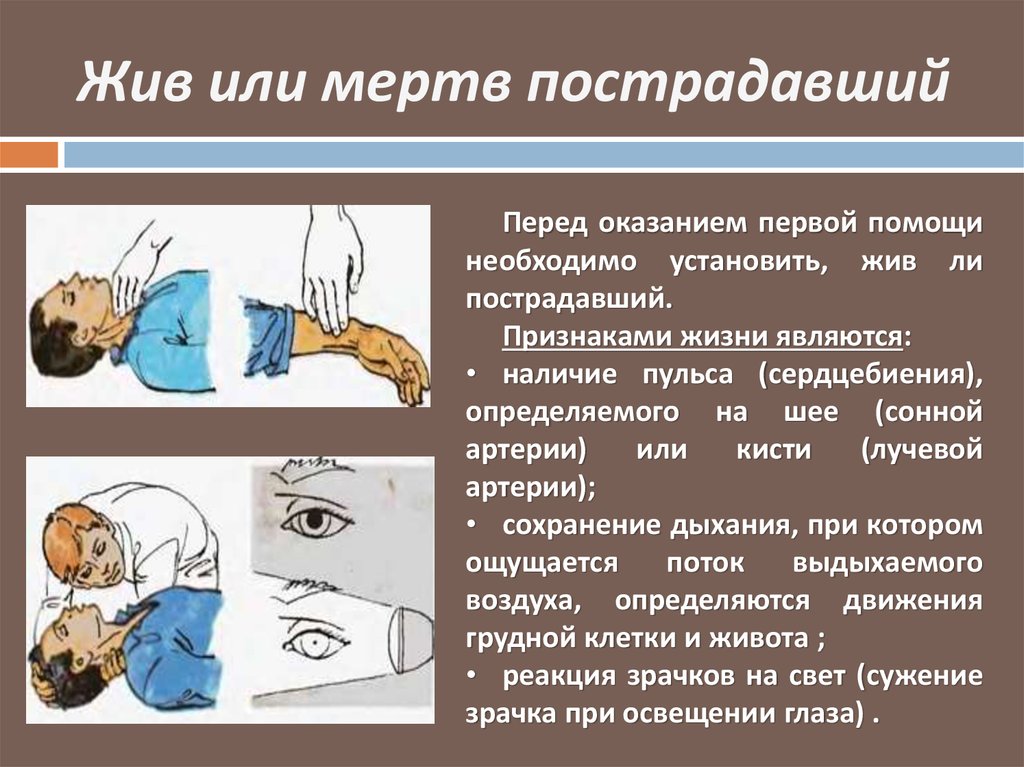 При определении жизни у пострадавшего проверяются. Как определить признаки жизни у пострадавшего. Определение признаков жив мертв. Признаки жизни при оказании первой помощи. Определение признаков жизни у пострадавшего.