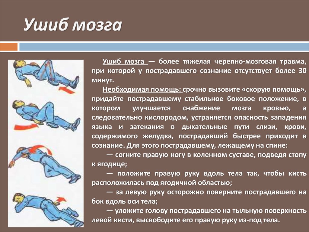 Какое положение необходимо придать пострадавшему. Первая помощь при ушибе головного мозга. Сотрясение и ушиб головного мозга первая помощь. Оказание первой медицинской помощи при сотрясении головного мозга. Первая помощь при сотрясениях и ушибах головного мозга.