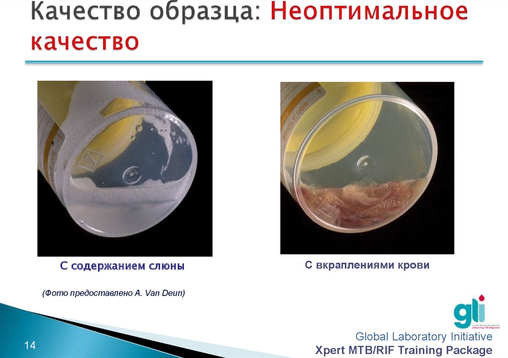 Презентация на тему мокрота