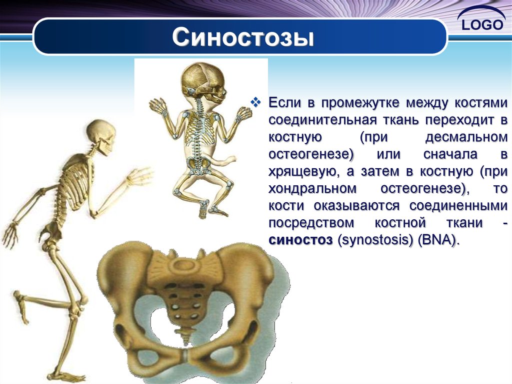 Зачем кости. Костные соединения синостозы. Синостоз. Синостозы в скелете. Синостозы примеры.