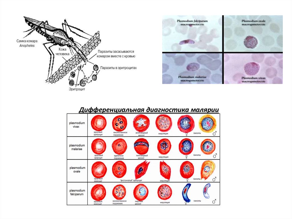 Малярия таблица. Малярийный плазмодий морфология. Диагностические признаки малярийного плазмодия. Лабораторная диагностика малярийного плазмодия. Малярийный плазмодий метод диагностики.
