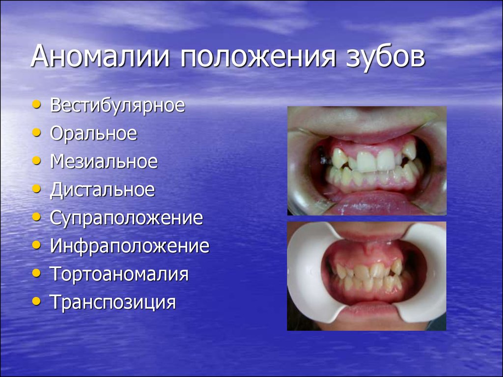 Отправляйтесь к электро аномалии и пройдите испытание геншин как пройти