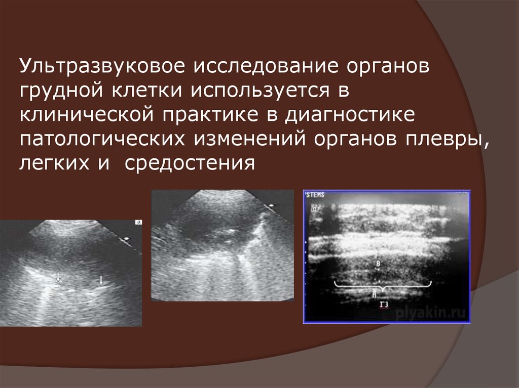 Ультразвуковое исследование презентация