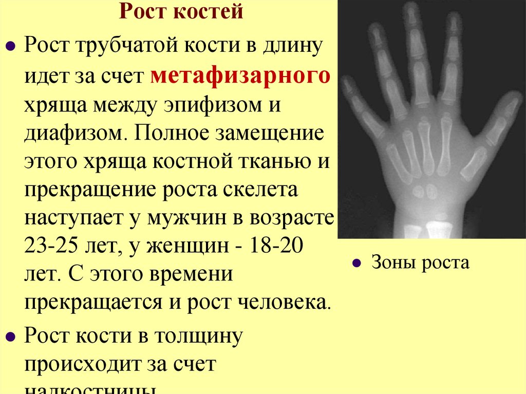 Рост кости в толщину за счет. Рост костей. Зоны роста костей. Рост кости в ширину. Рост костей в длину осуществляется за счет метафизарного хряща.