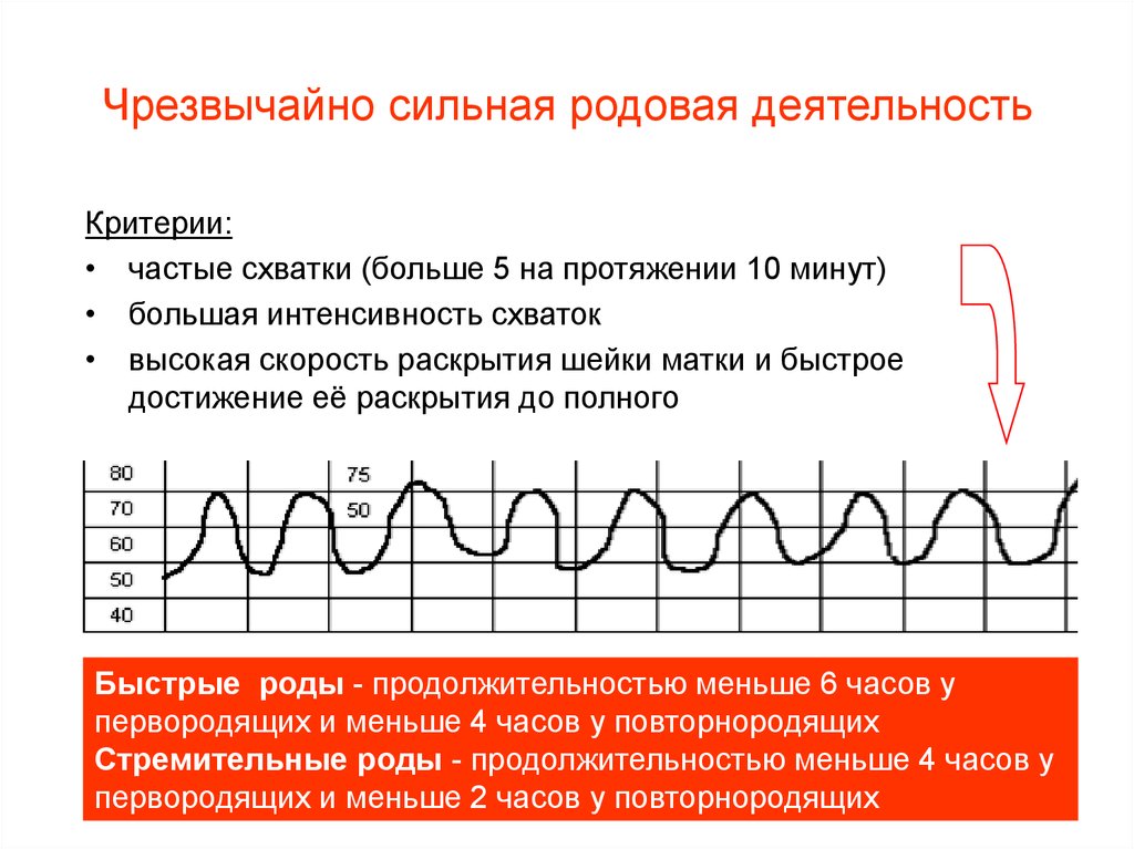 Схватки 8 минут