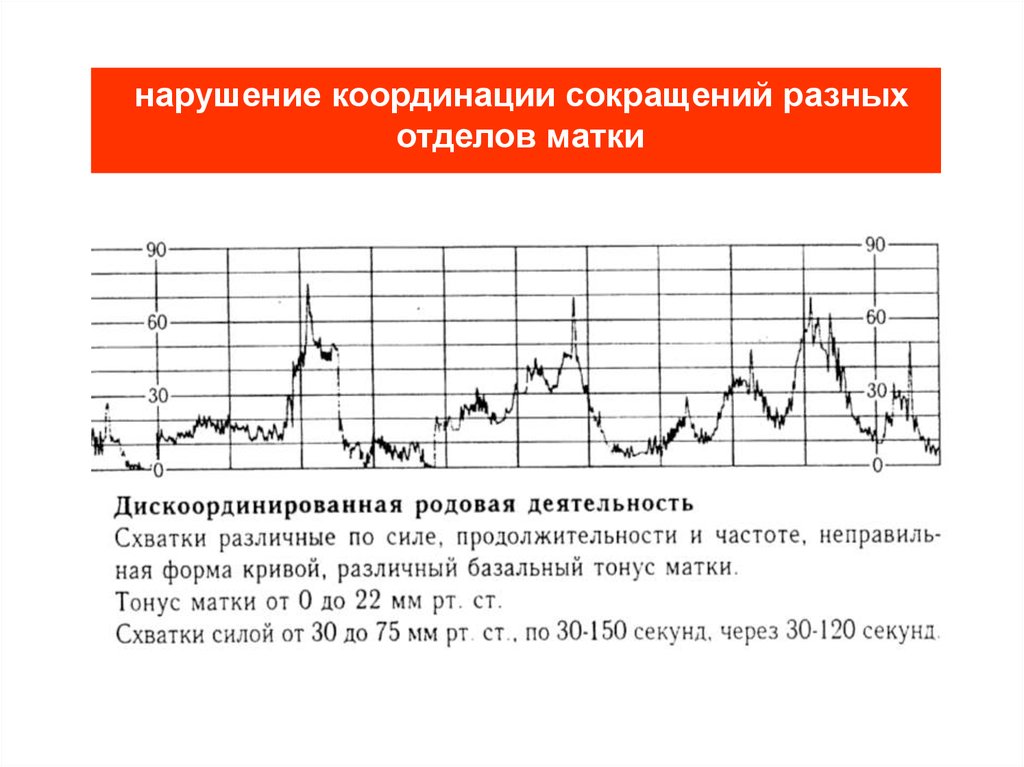 Оценка схваток