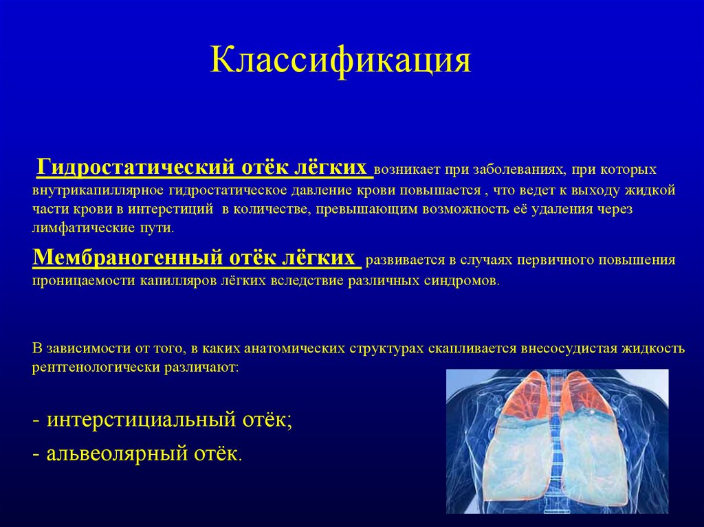 Презентация на тему отек легких