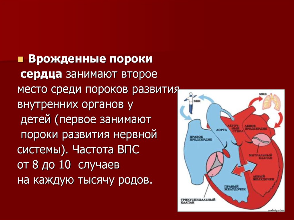 Какие пороки сердца. Частота развития врожденных пороков сердца. Врожденный порок сердца (ВПС). Врождённые пороки ердца. Парожденные пороки сердца.