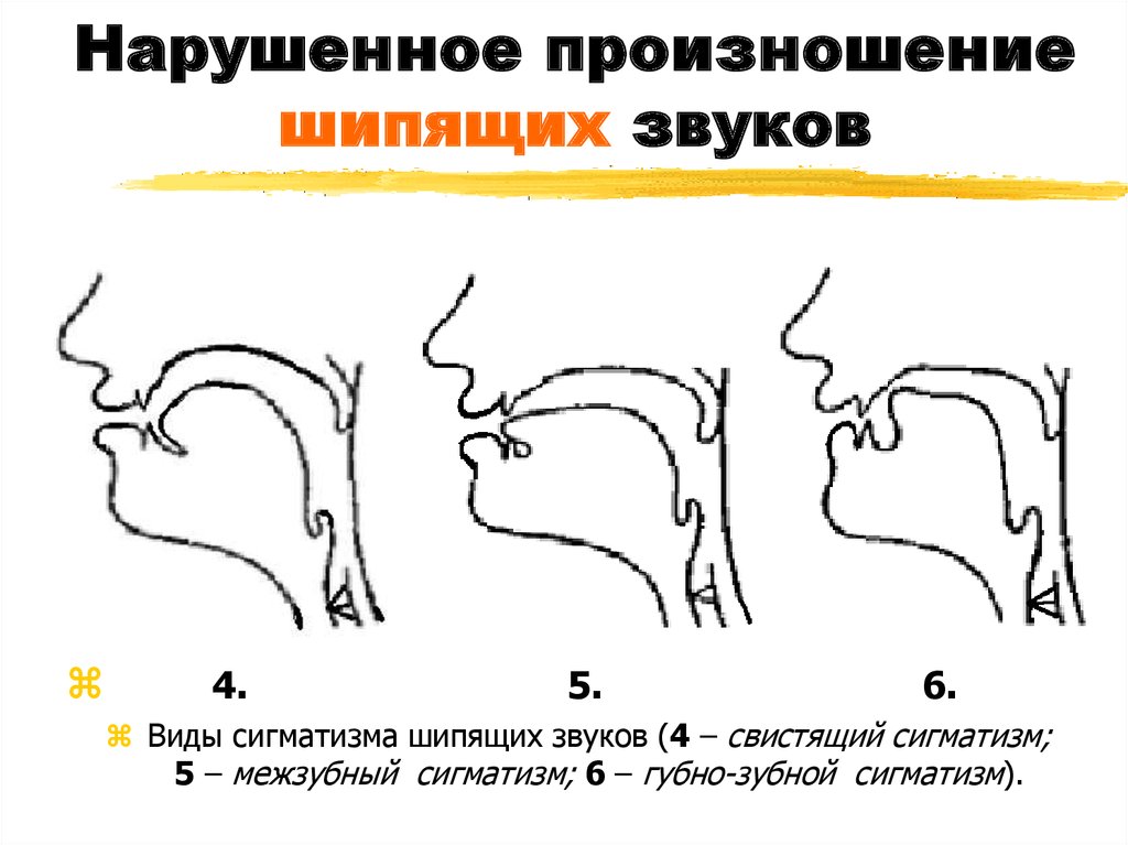 Произношение звуков речи. Губно зубной сигматизм звука с. Губно-зубной сигматизм звука ш. Губно-зубной сигматизм свистящих звуков. Губно-зубной сигматизм шипящих звуков.