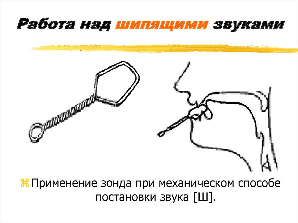 Постановка звука ш. Звук [ш] механическим способом ставится. Логопедические зонды для постановки шипящих звуков. Постановка звука ш зондом механическим способом. Логопедические зонды дляпостаговки шипящих звуков.