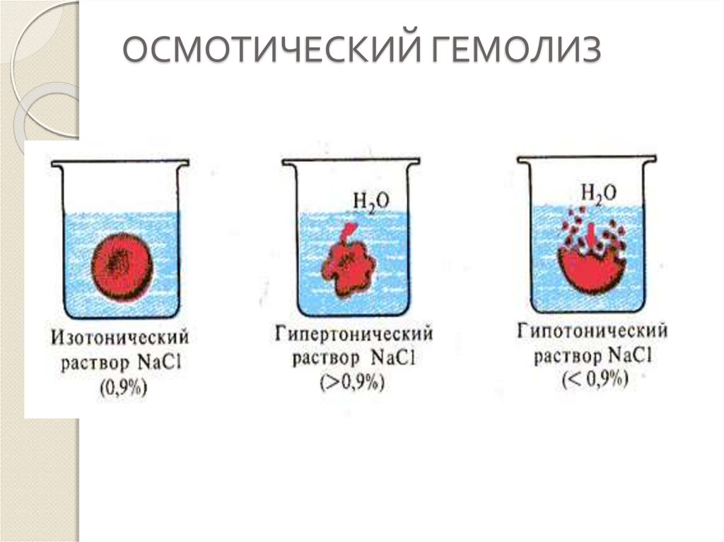 Эритроциты в растворе хлорида натрия