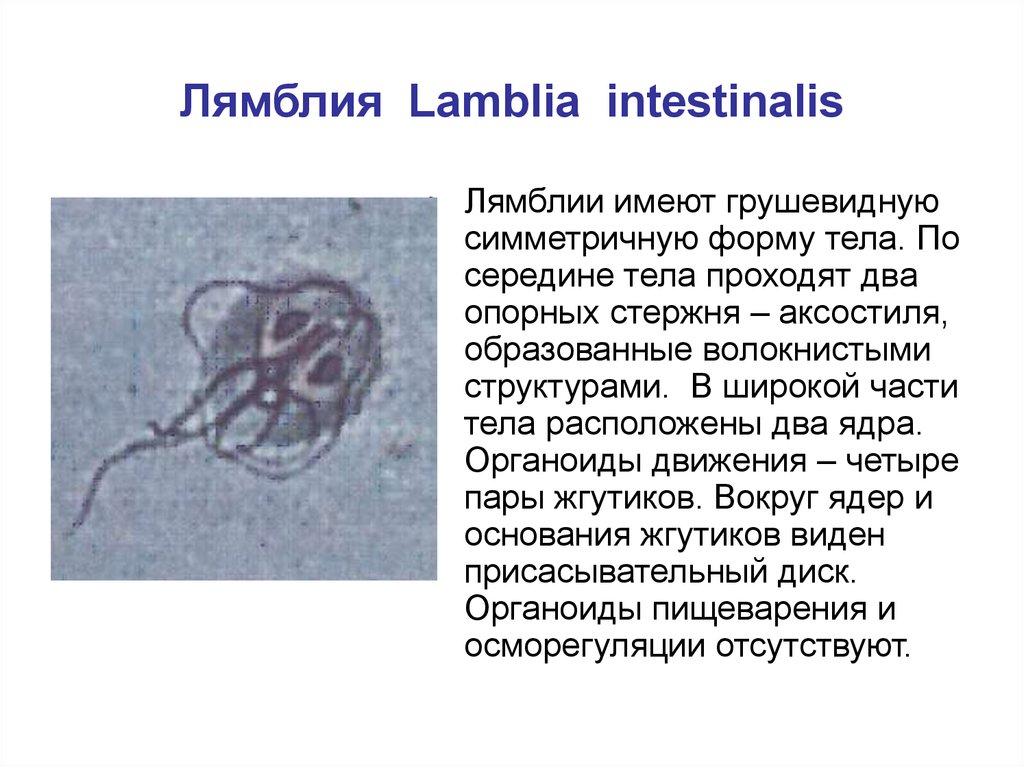 Лямблия тип. Лямблия интестиналис классификация. Lamblia intestinalis вызывает заболевание. Lamblia intestinalis заболевание. Лямблии intestinalis.