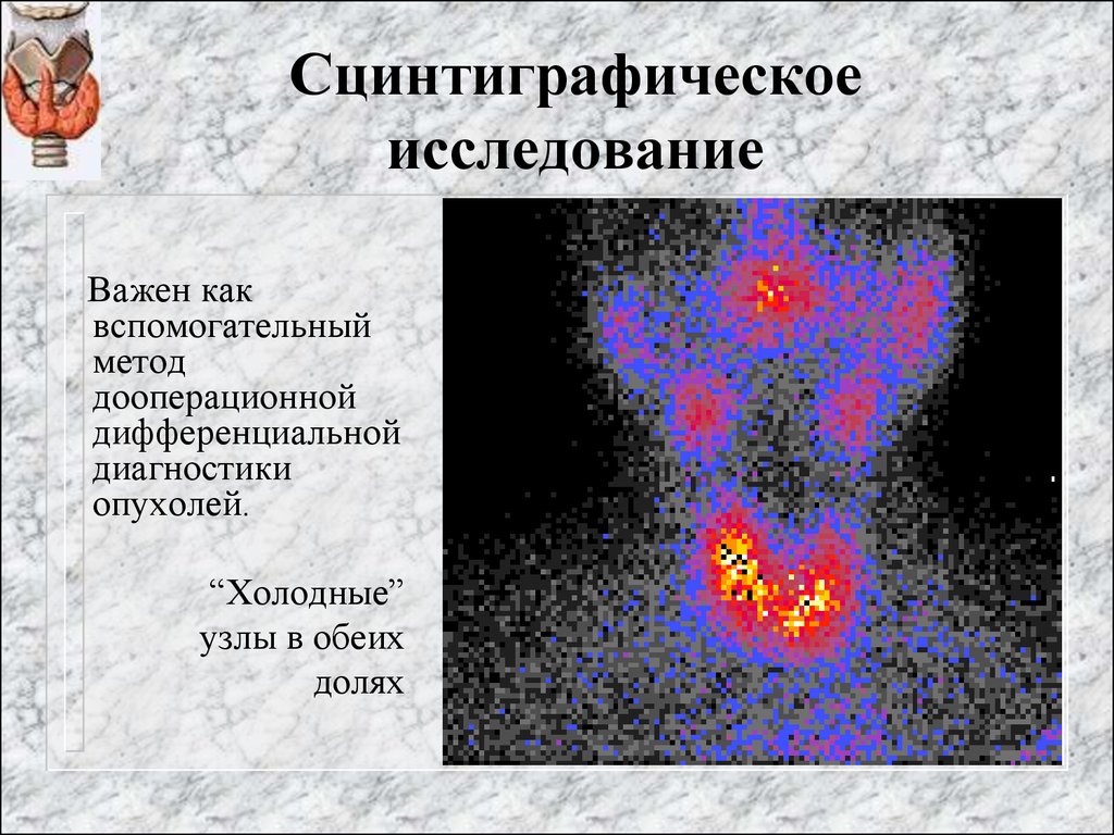 Щитовидная железа исследование