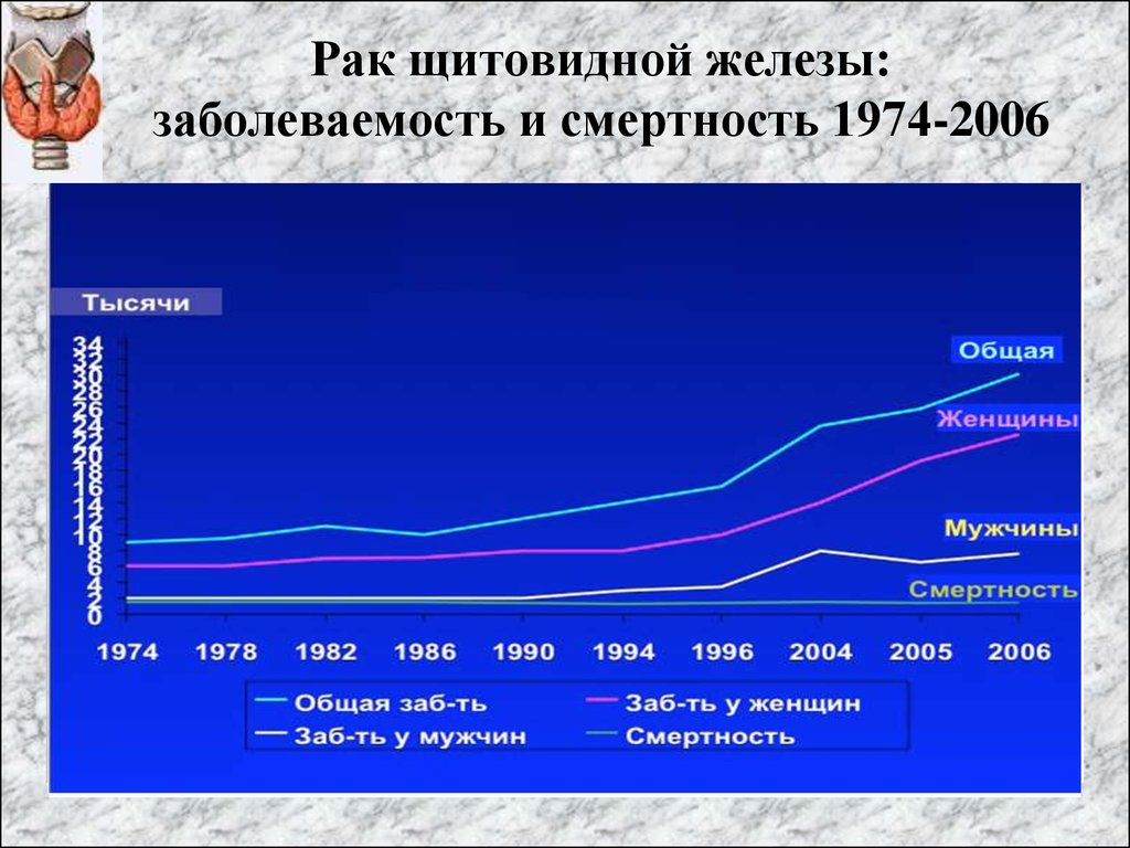 Рак желез. Статистика заболеваний щитовидной железы в России диаграмма. Частота заболеваний щитовидной железы. Распространенность заболеваний щитовидной железы. Опухоли щитовидной железы заболеваемость.