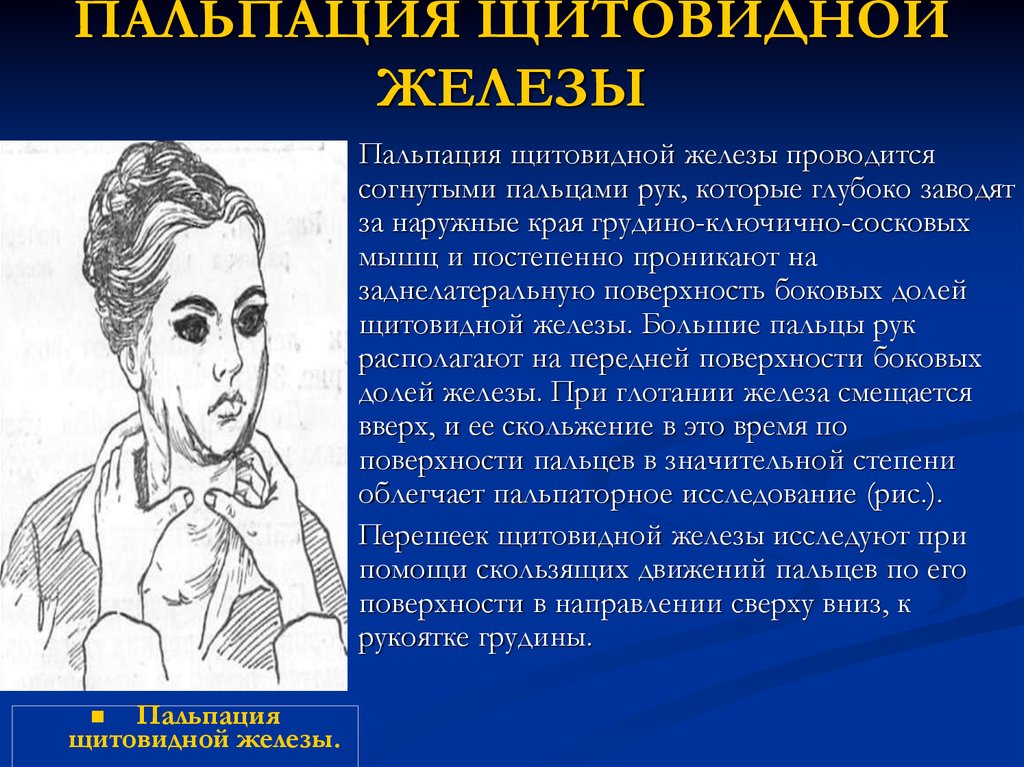 Изменения щитовидной. Пальпация щитовидной ЖЛ. Пальпация щитовидной железы алгоритм. Методика проведения пальпации щитовидной железы. Пальпация щитовидной железы пропедевтика.