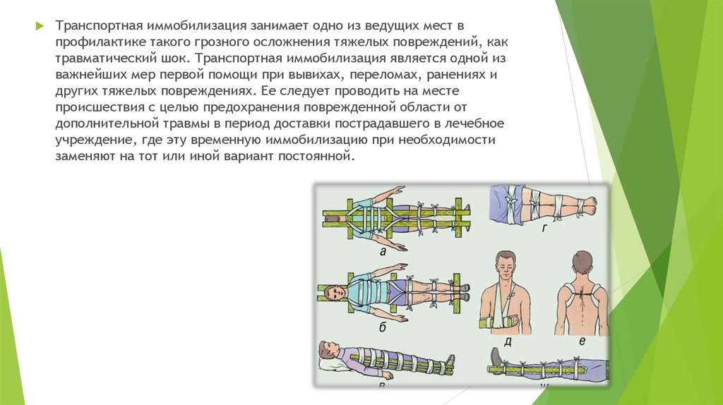 Транспортная проводящая. Транспортная иммобилизация при травмах. Иммобилизация и транспортировка пострадавших. Иммобилизация пострадавшего. Транспортная иммобилизация осуществляется.