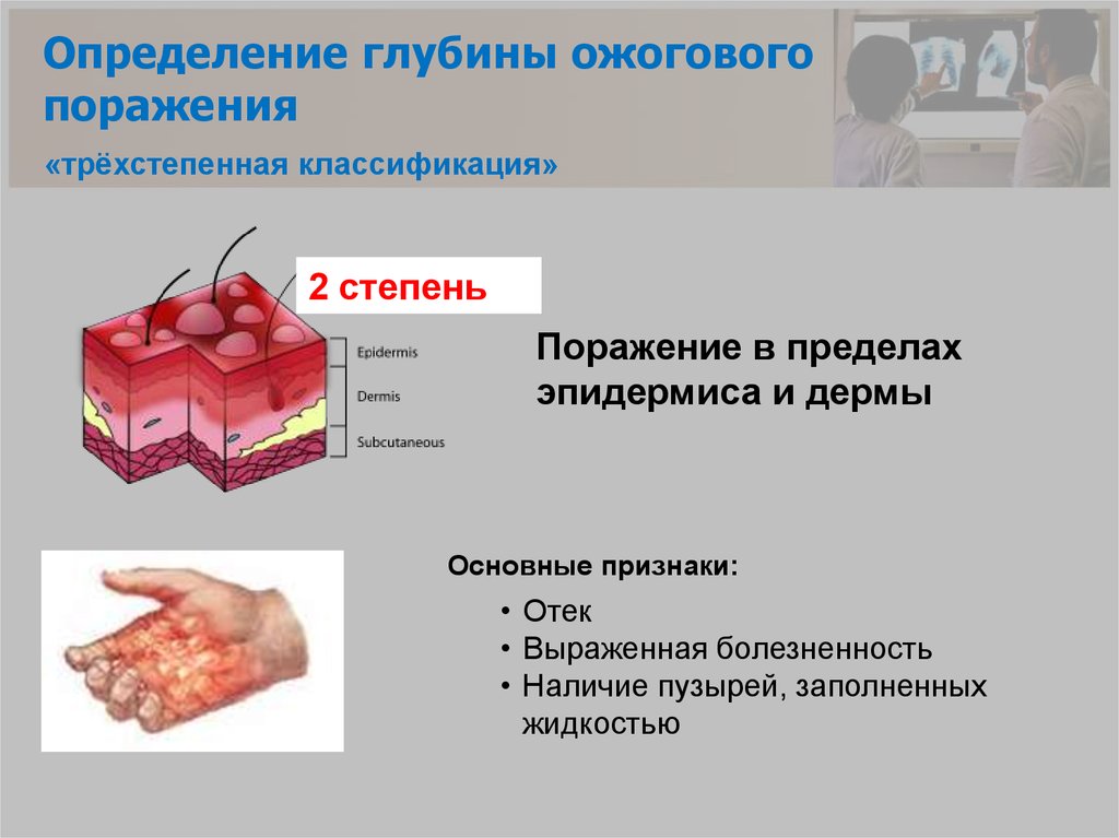 Определение глубины ожогового поражения