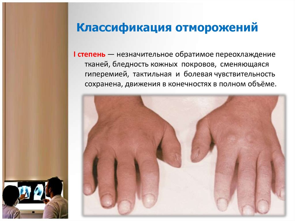 Классификация отморожений