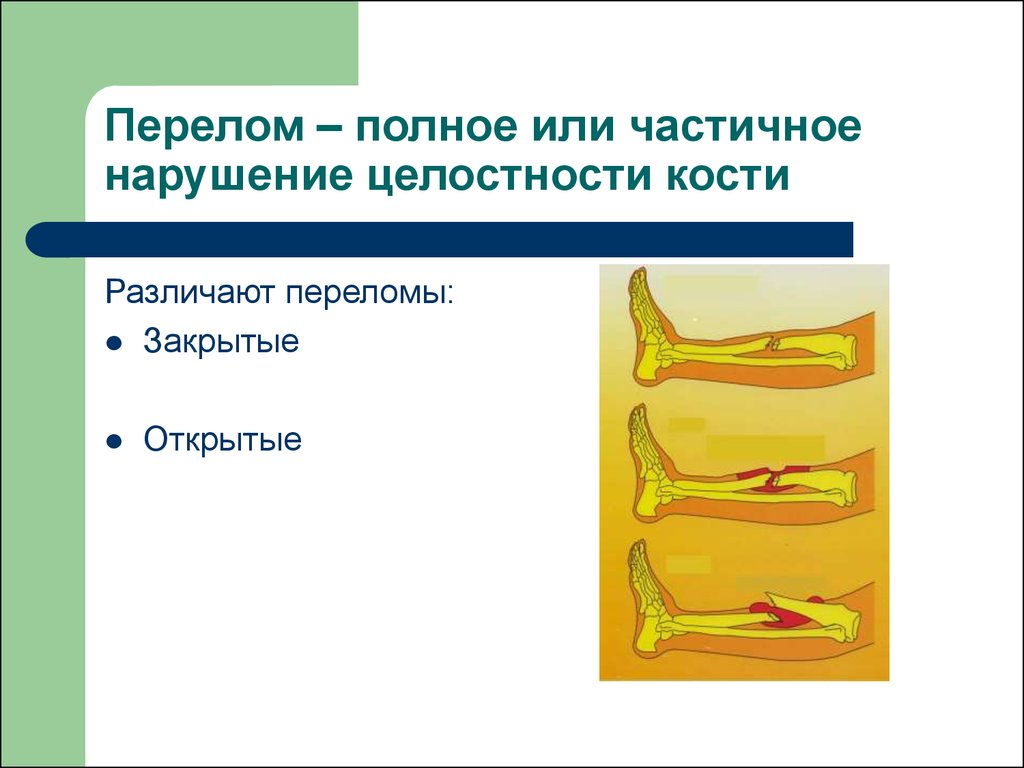 Первая помощь при травмах биология 8 класс презентация