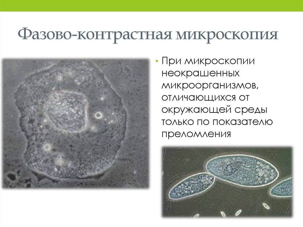 Фазово контрастная микроскопия. Фазово-контрастная микроскопия принцип. Фазово-контрастная микроскопия клетка. Метод фазово-контрастной микроскопии. Фазово-контрастная микроскопия бактерии.