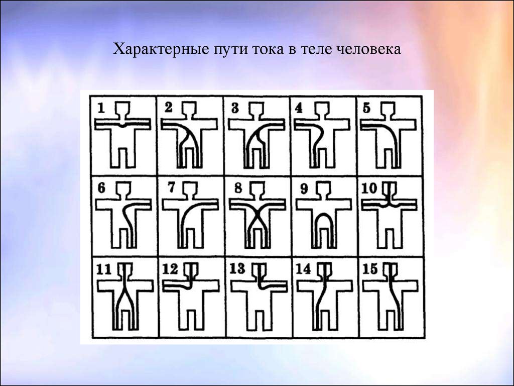 Опасный путь протекания электротока через человека. Путь тока в теле человека. Характерные пути тока в теле человека. Путь тока через тело человека. Пути прохождения электрического тока через тело человека.