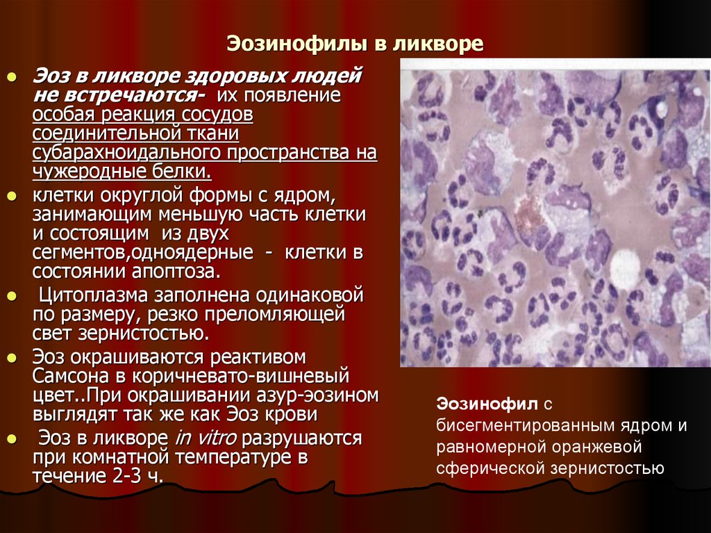 Эритроциты макрофаги. Цитоз СМЖ. Лимфоциты и нейтрофилы в ликворе.