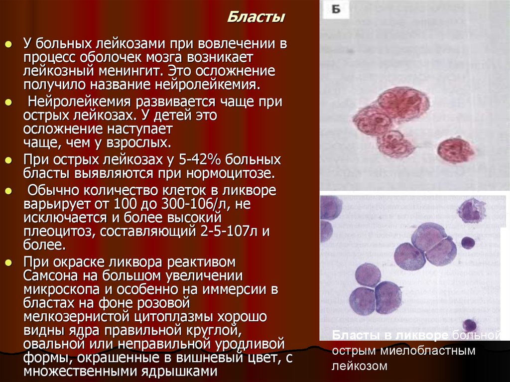 Бласты в крови фото