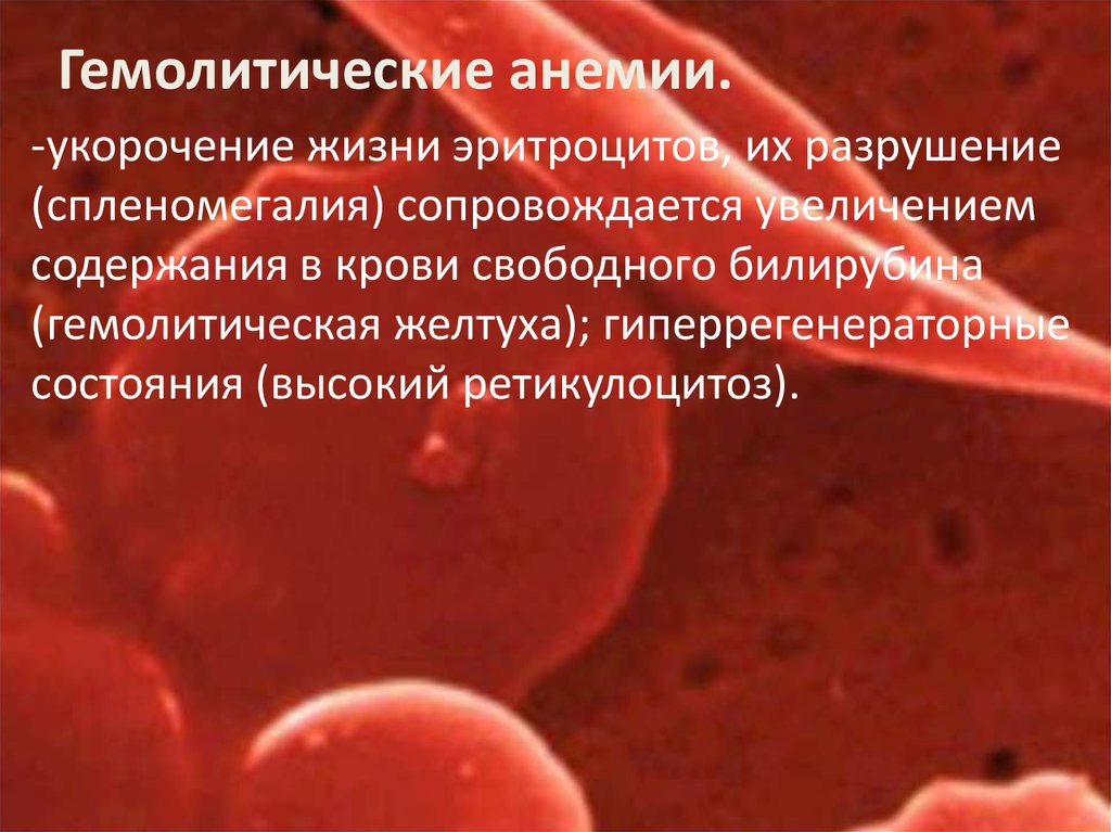 Анемия гемолитического типа. Гемолитические анемии гиперрегенераторные. Гемолитическая анемия гемоглобин. Гемоглобин при гемолитической анемии. Виды гемолитических анемий.
