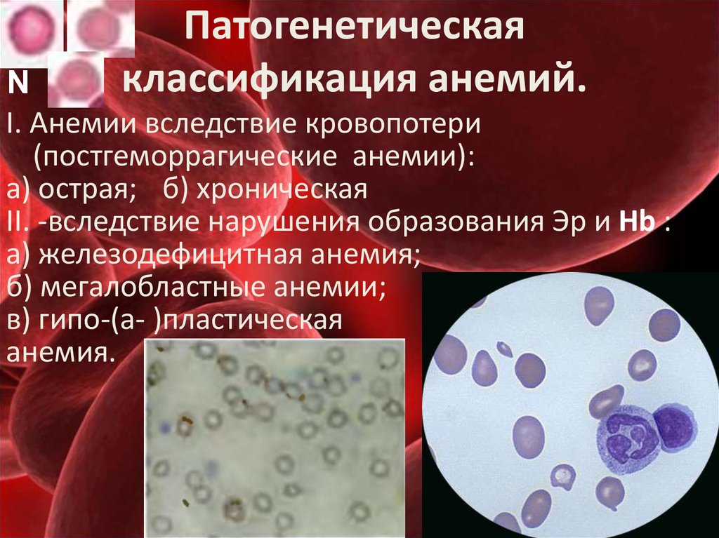 Мегалобластная анемия презентация